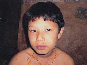 Lapka Tamang, victim of torture in Nepal